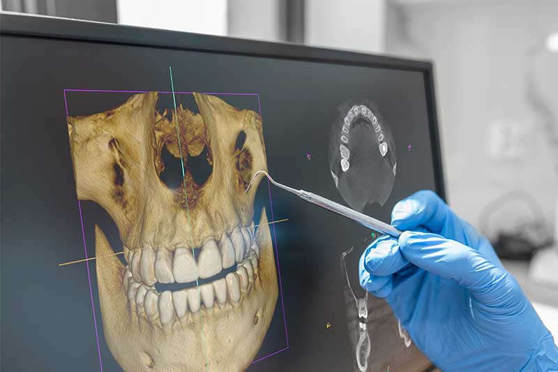 3d_cone_beam_imagine